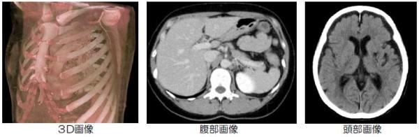3D画像・腹部画像・頭部画像