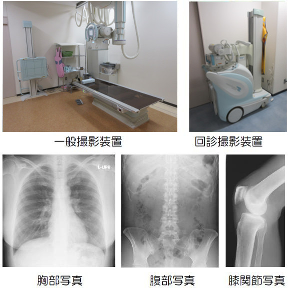 一般撮影装置