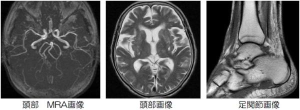 頭部MRA・頭部・足関節画像